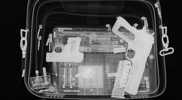 X-ray image with FLATSCAN portable system