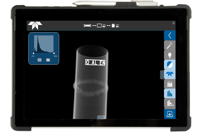 Illustration of: Digital Radiography